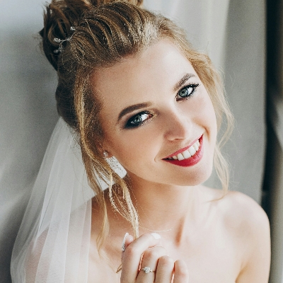 When to start teeth whitening before your wedding, from someone who got it wrong